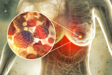 Types & Stages of Breast Cancer